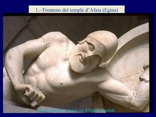 Guerrer ferit del frontó est d’Egina. Munich. 1.- Frontons del temple d’Afaia (Egina) 