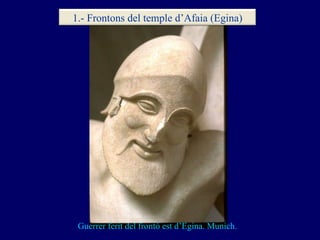 Guerrer ferit del frontó est d’Egina. Munich. 1.- Frontons del temple d’Afaia (Egina) 