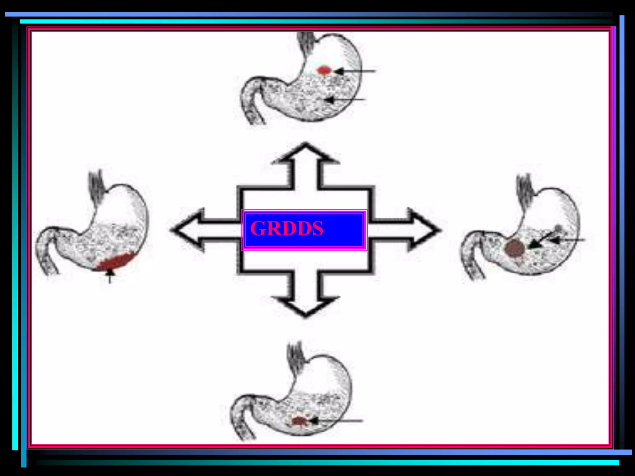 GRDDS
 