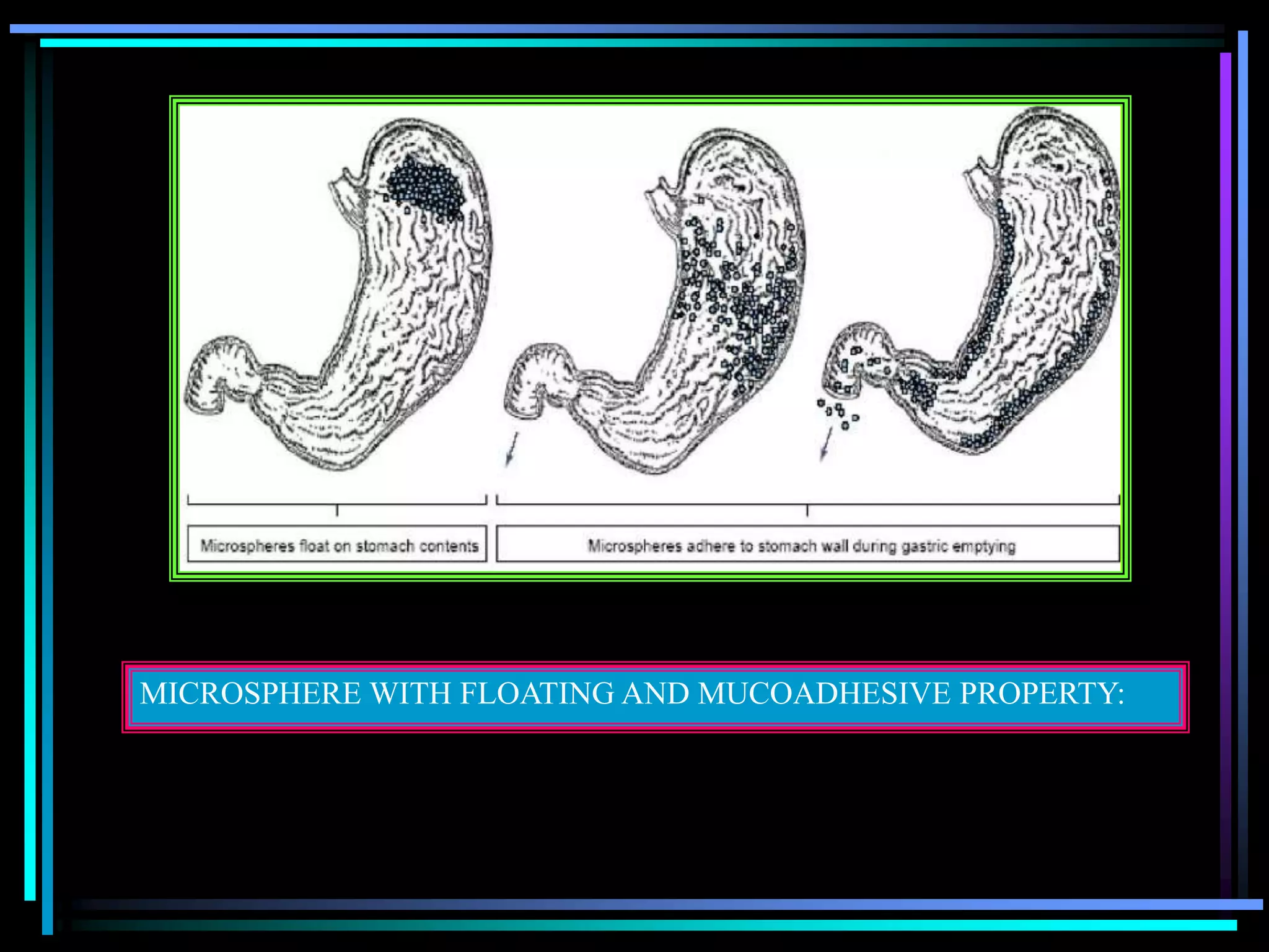 MICROSPHERE WITH FLOATING AND MUCOADHESIVE PROPERTY:
 