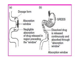 Gastrorentative drug delivery systems GRDDS