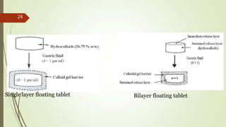 Single layer floating tablet Bilayer floating tablet
24
 