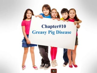 Chapter#10
Greasy Pig Disease
1
 