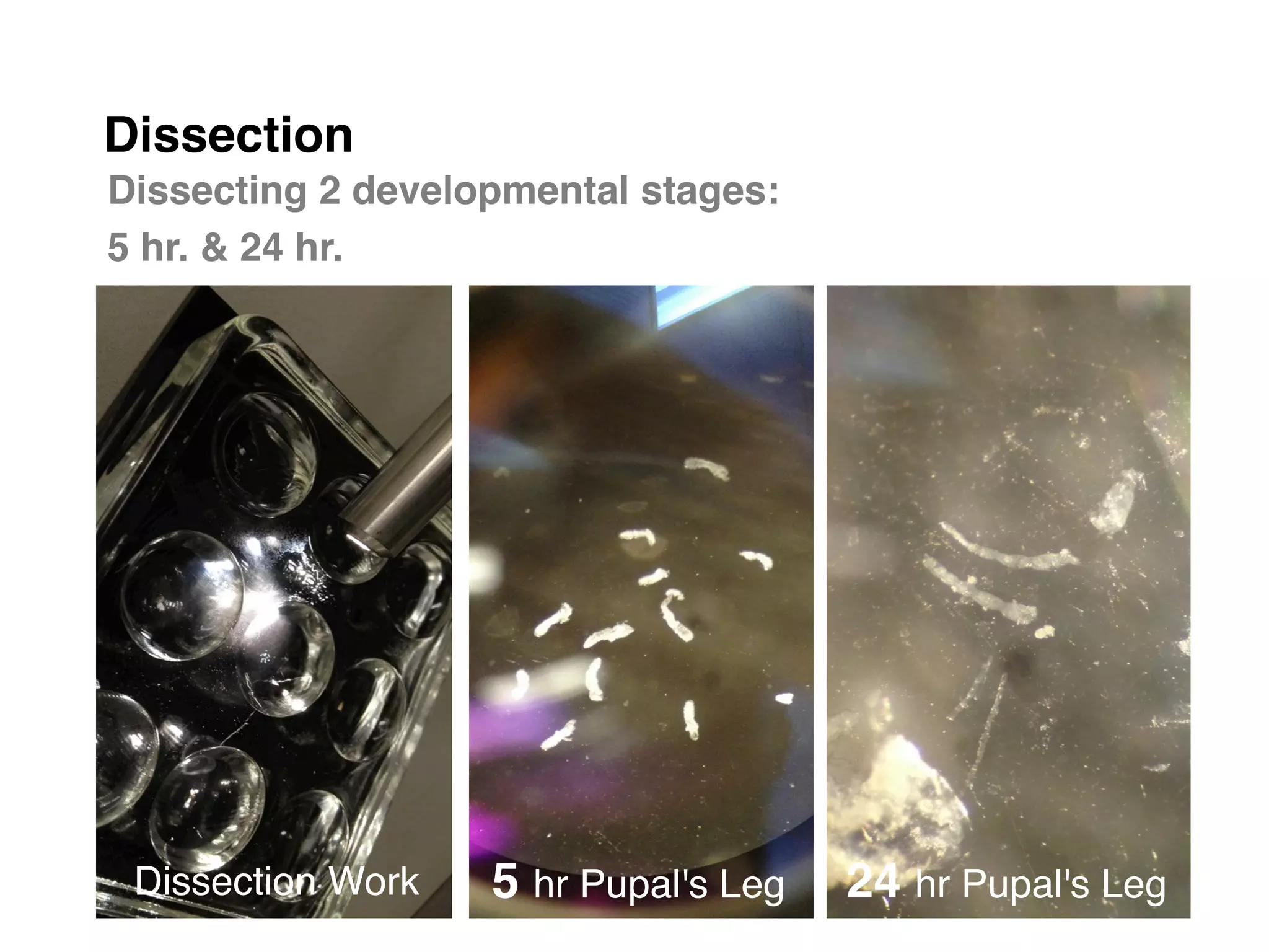 Dissection	

Dissecting 2 developmental stages: "
5 hr. & 24 hr."




 Dissection Work!   5 hr Pupal's Leg! 24 hr Pupal's Leg!
 