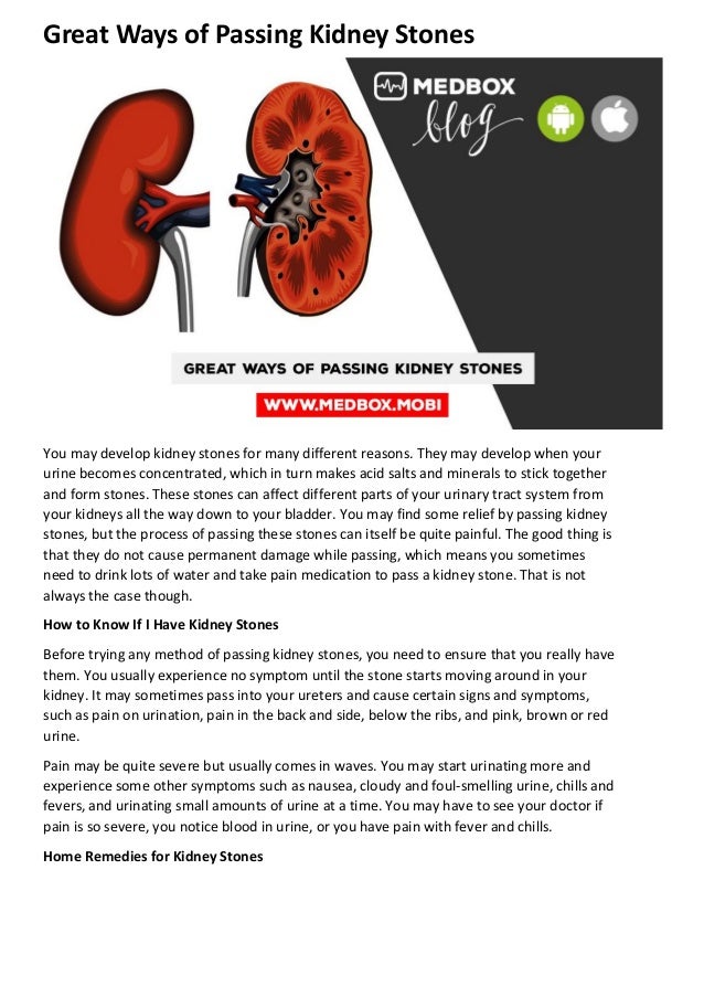 Great ways of passing kidney stones