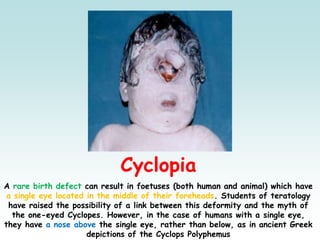 ὀφθαλμός (ophthalmós) | PPT