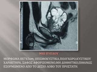 ΣΤΕΝΩΣΗ ΟΥΡΗΤΗΡΑ