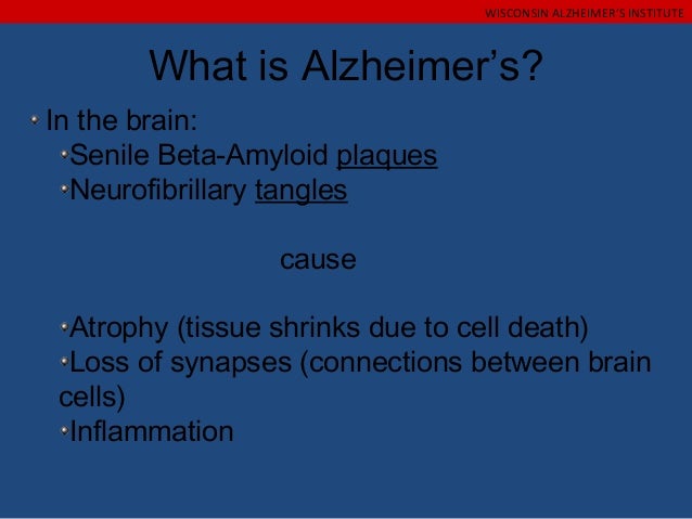 What are the types of dementia?