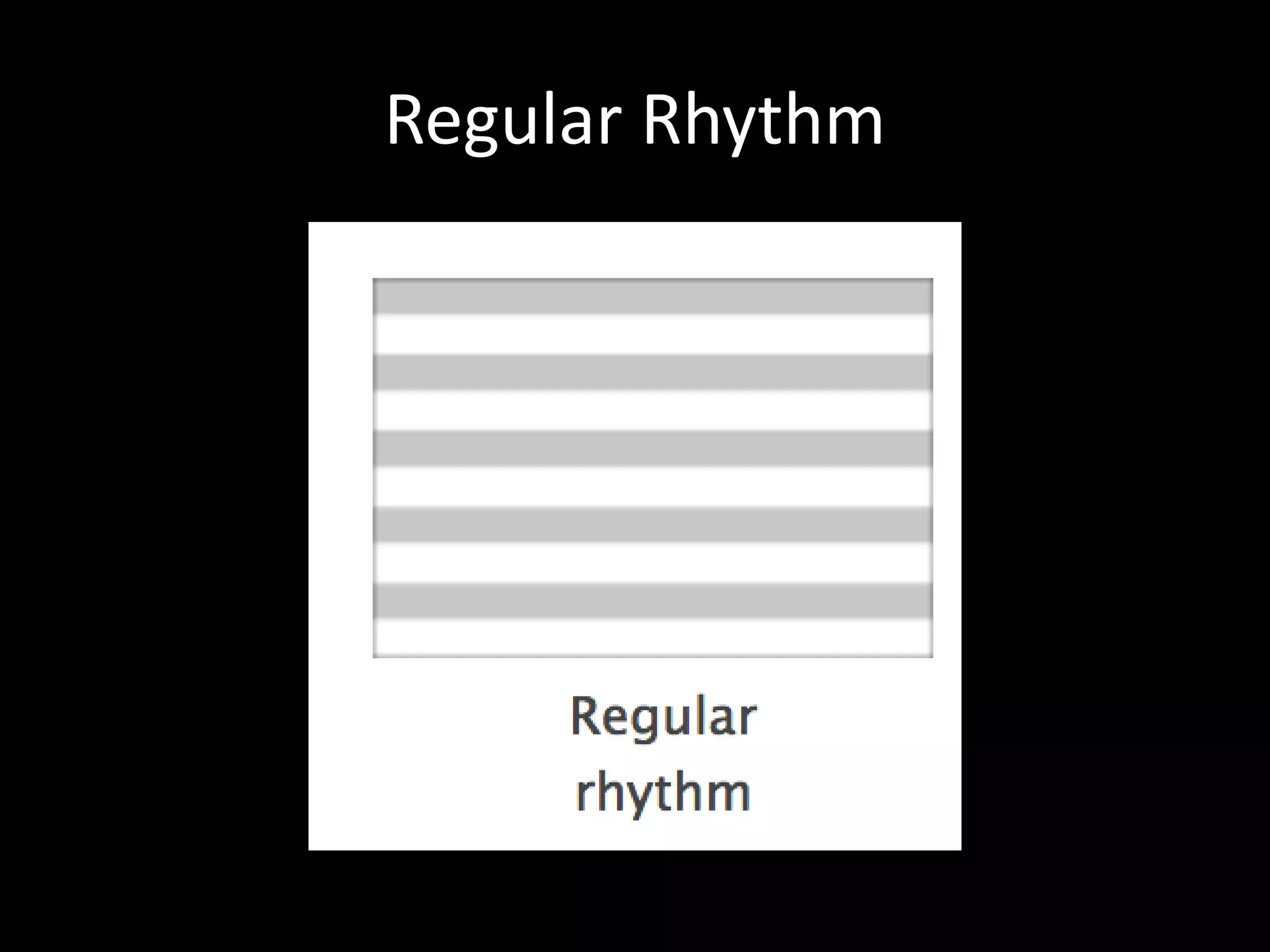 Regular Rhythm
 