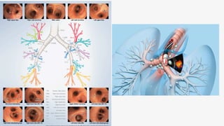 What is a bronchoscopy? test live videos