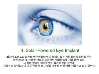 4. Solar-Powered Eye Implant최근에 스탠포드 대학의 연구원들이 앞이 보이지 않는 사람들에게 희망을 주는 태양에너지를 사용한 새로운 인공망막 임플란트를 개발 중에 있다. 그 동안 인공망막의 문제는 칩에 충분한 전력을 제공하는 것이었는데 아주 작은 광전지 셀을 개발해 이 문제를 해결하고 있는 것이다.