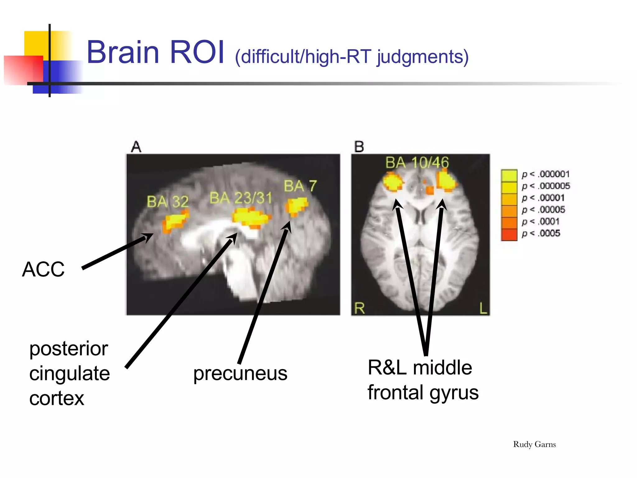 Brain ROI  (difficult/high-RT judgments) ACC precuneus posterior cingulate cortex R&L middle frontal gyrus 