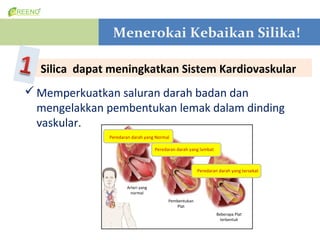 Menerokai Kebaikan Silika!

  Silica dapat meningkatkan Sistem Kardiovaskular
? Memperkuatkan saluran darah badan dan
  mengelakkan pembentukan lemak dalam dinding
  vaskular.
              Peredaran darah yang Normal

                                   Peredaran darah yang lambat



                                                       Peredaran darah yang tersekat


                     Arteri yang
                       normal
                                         Pembentukan
                                            Plat
                                                                 Beberapa Plat
                                                                   terbentuk
 