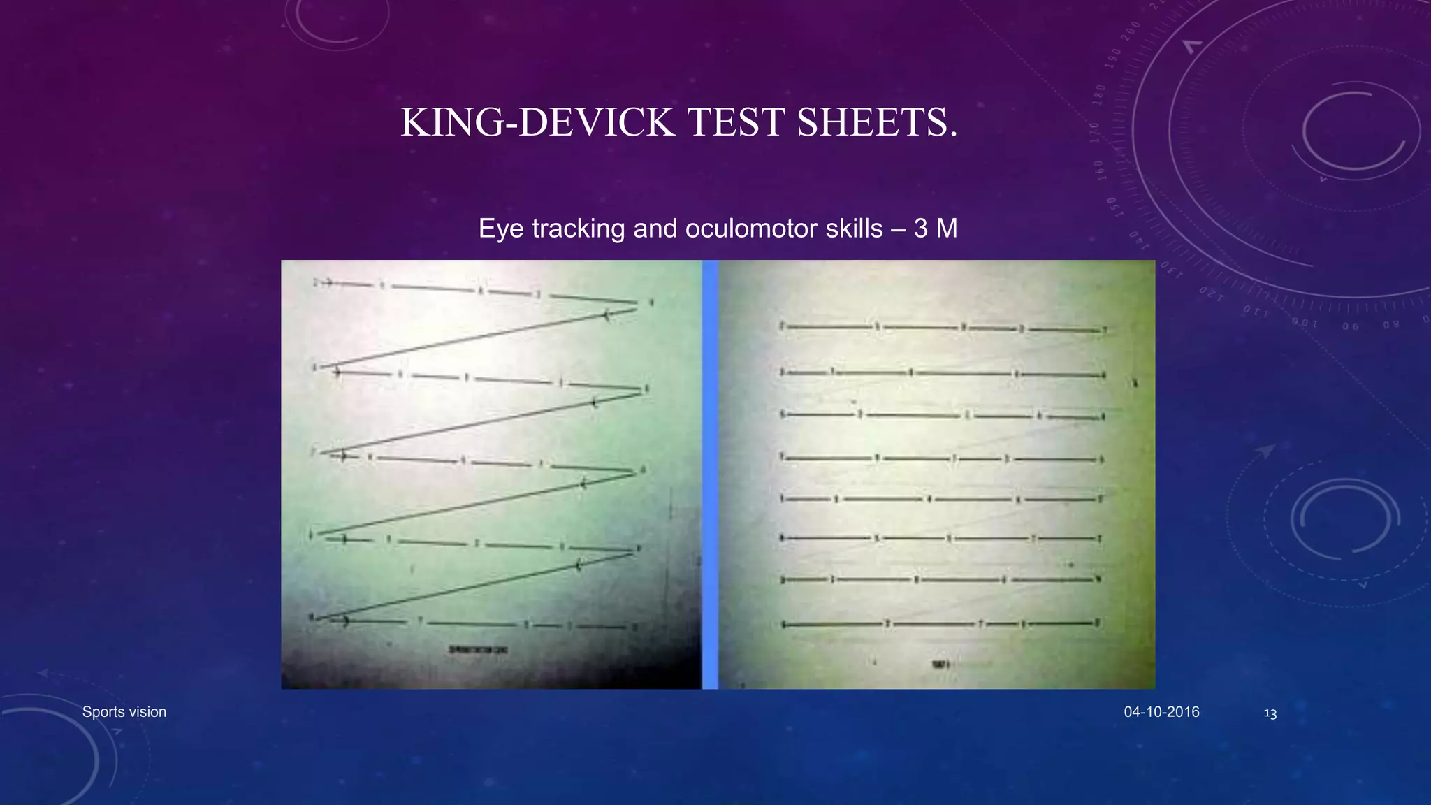 KING-DEVICK TEST SHEETS.
04-10-2016Sports vision 13
Eye tracking and oculomotor skills – 3 M
 