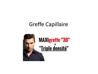 Greffe Capillaire
 