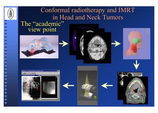 Conformal radiotherapy and IMRT
          in Head and Neck Tumors
The “academic”
  view point
 