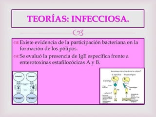 
TEORÍAS: INFECCIOSA.
 Existe evidencia de la participación bacteriana en la
formación de los pólipos.
 Se evaluó la presencia de IgE específica frente a
enterotoxinas estafilocócicas A y B.
 