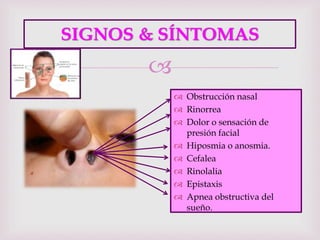 
SIGNOS & SÍNTOMAS
 Obstrucción nasal
 Rinorrea
 Dolor o sensación de
presión facial
 Hiposmia o anosmia.
 Cefalea
 Rinolalia
 Epistaxis
 Apnea obstructiva del
sueño.
 