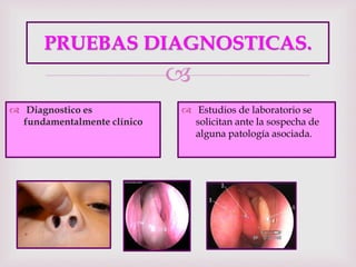 
PRUEBAS DIAGNOSTICAS.
 Diagnostico es
fundamentalmente clínico
 Estudios de laboratorio se
solicitan ante la sospecha de
alguna patología asociada.
 