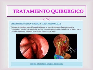 
TRATAMIENTO QUIRÚRGICO
 
