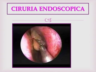 
CIRURIA ENDOSCOPICA
 