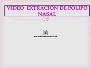 
VIDEO EXTRACION DE POLIPO
NASAL
 