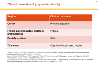 Grey matter and multiple sclerosis | PDF