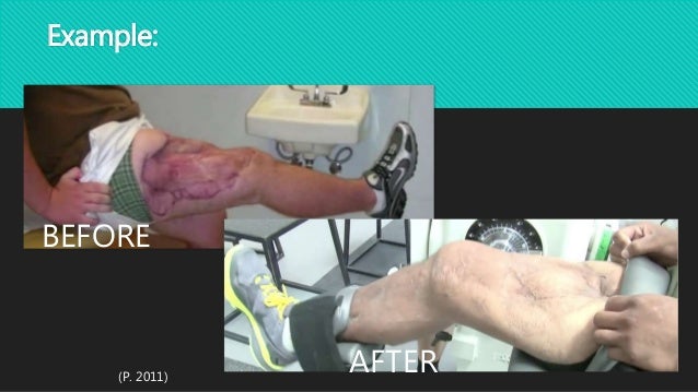 medical technology example thevillas co