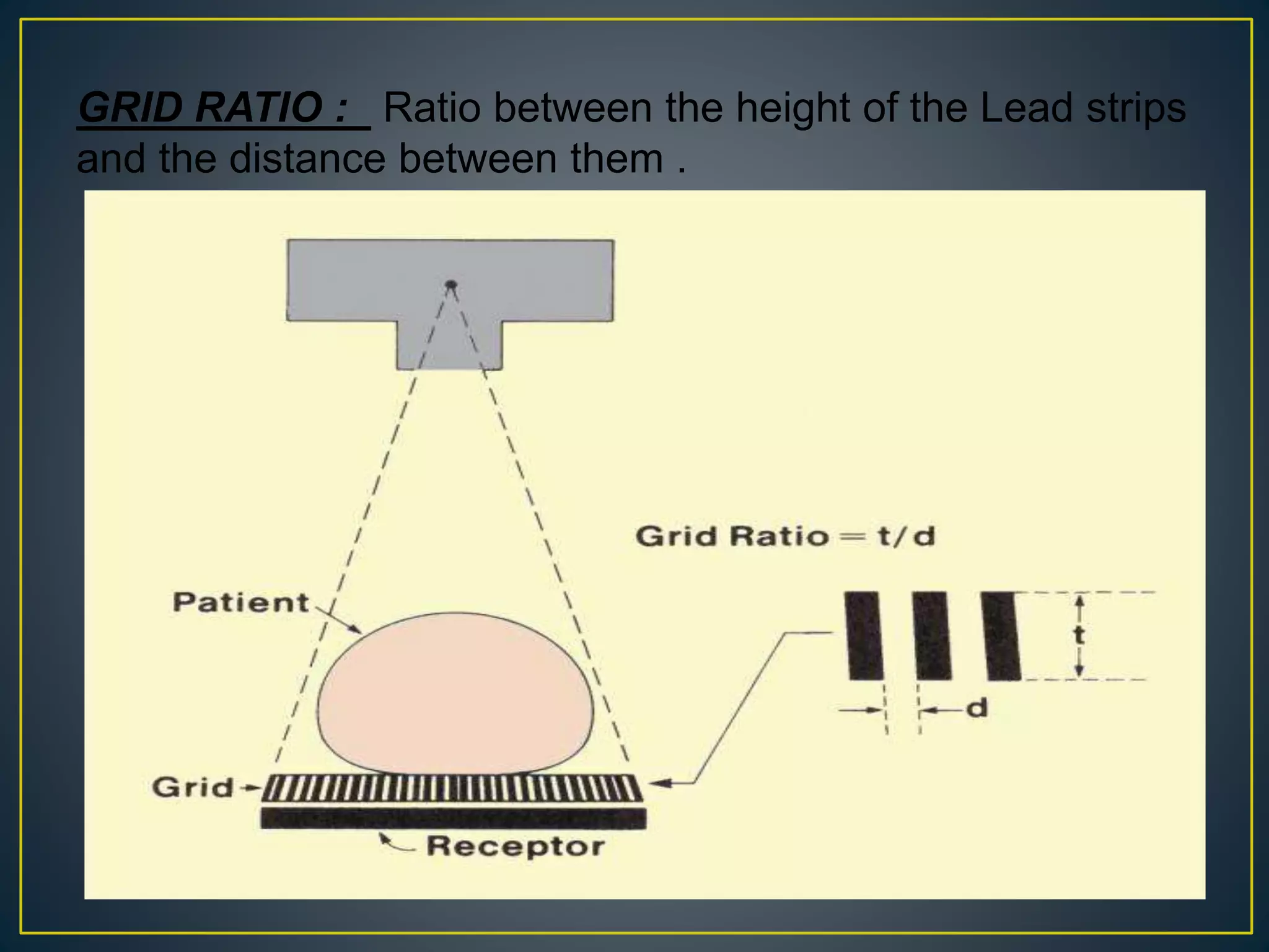 GRID RATIO : Ratio between the height of the Lead strips
and the distance between them .
 