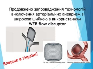 Продовжено запровадження технологій
виключення артеріальних аневризм з
широкою шийкою з використанням
WEB flow disruptor
 