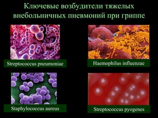 Ключевые возбудители тяжелых
внебольничных пневмоний при гриппе
Streptococcus pneumoniae Haemophilus influenzae
Staphylococcus aureus Streptococcus pyogenes
 