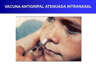 VACUNA ANTIGRIPAL ATENUADA INTRANASAL
 