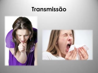 Transmissão
 
