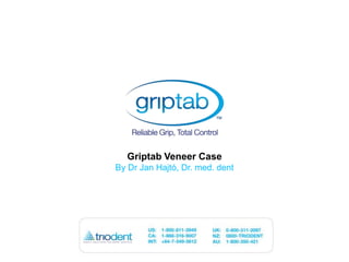 Griptab Veneer Case By Dr Jan Hajtó, Dr. med. dent 