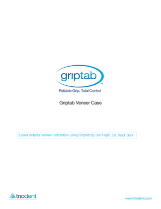 Griptab Veneer Case




Lower anterior veneer restoration using Griptab by Jan Hajtó , Dr. med. dent
 
