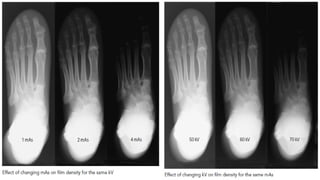 Plural Sign Radiograph General radiology lec 2 (radiographic imaging).pptx