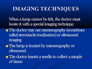 IMAGING TECHNIQUES
When alump cannot be felt, the doctor must
locate it with a special imaging technique.
■ The doctor may use mammography (sometimes
calledstereotacticlocalization)orultrasound
imaging
■ The lump is located by mammography or
ultrasound
■ The doctor inserts aneedle to collect asample
of tissue
 