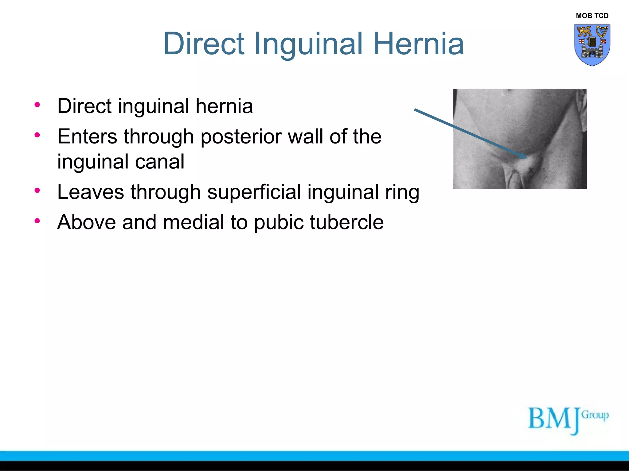 Anatomy of Groin | PPT
