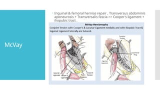 Mcvay Incision Groin Hernias types history and operations | PPTX