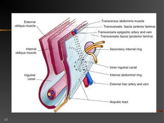 Direct Inguinal Hernia
 