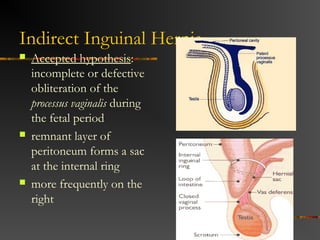 Terminology
 Reducible – can be replaced within
surrounding musculature
 Incarcerated – cannot be reduced
 Strangulated – compromised blood supply to
its contents
 
