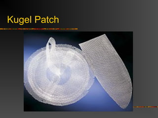 Laparoscopic Procedures
 Increasingly popular, controversial
 Early in the development, hernias were
repaired by placing very large mesh over
entire inguinal region on top of the
peritoneum. Was abandoned because of
contact with bowel.
 Today, most performed TEP or TAPP
 