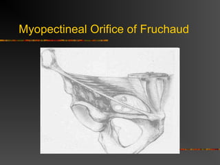 Myopectineal Orifice of Fruchaud
 
