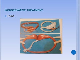 CONSERVATIVE TREATMENT
 Truss
 