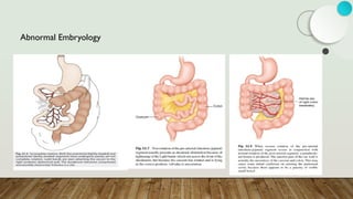 Abnormal Embryology
 