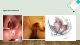 Physical Examination
 