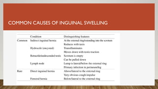 COMMON CAUSES OF INGUINAL SWELLING
 