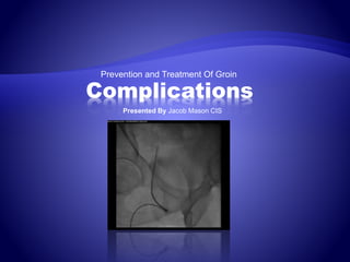 Prevention and Treatment Of Groin
Complications
Presented By Jacob Mason CIS
 