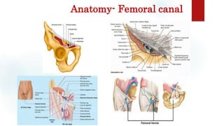 Anatomy- Femoral canal
 