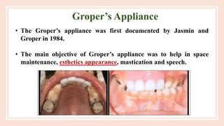 GROPERS APPLIANCE and its use in dentistry | PPTX